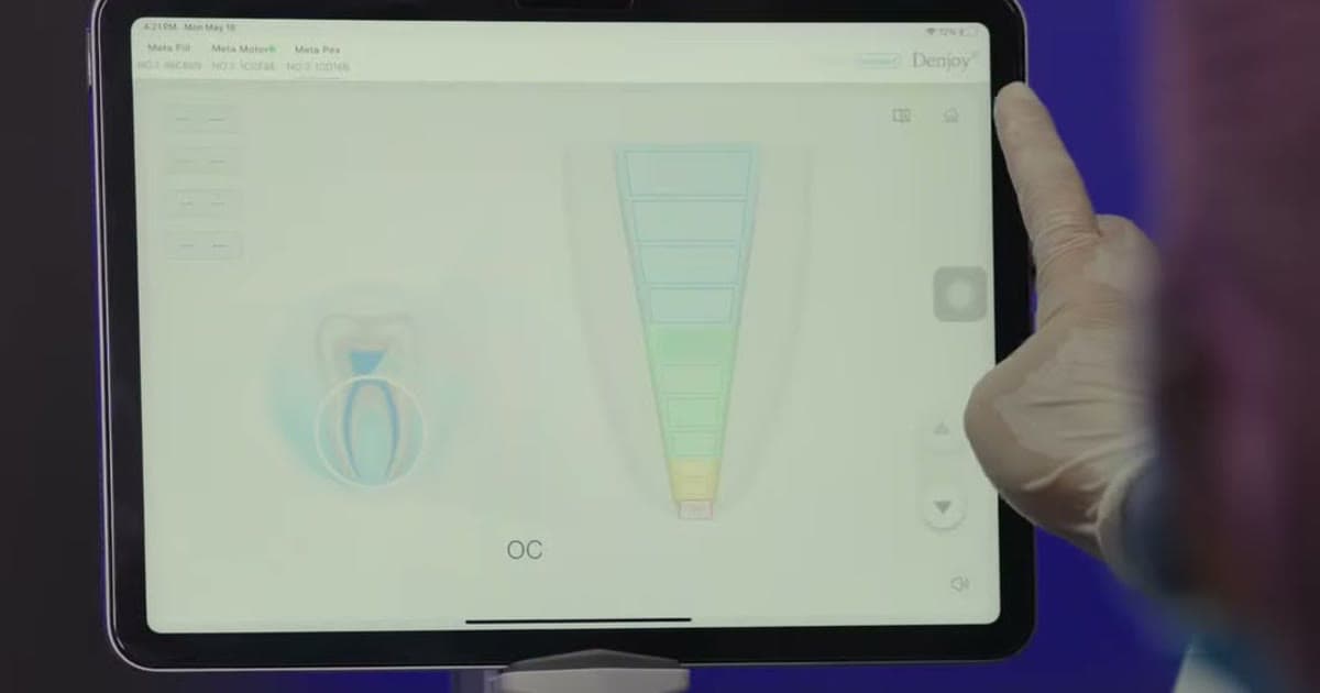 A Dentist on Using Denjoy Every Day