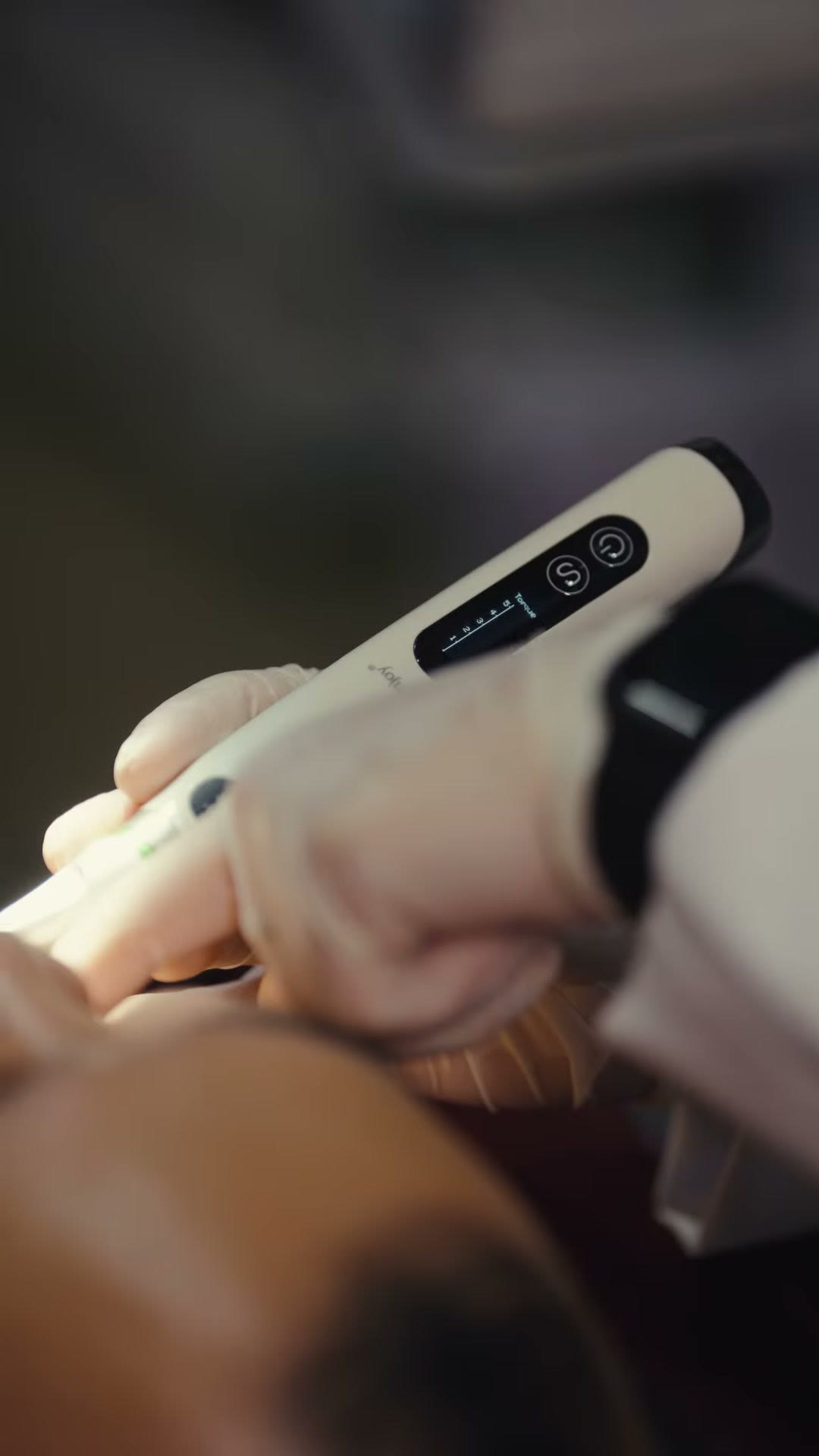 The endo motor display during treatment