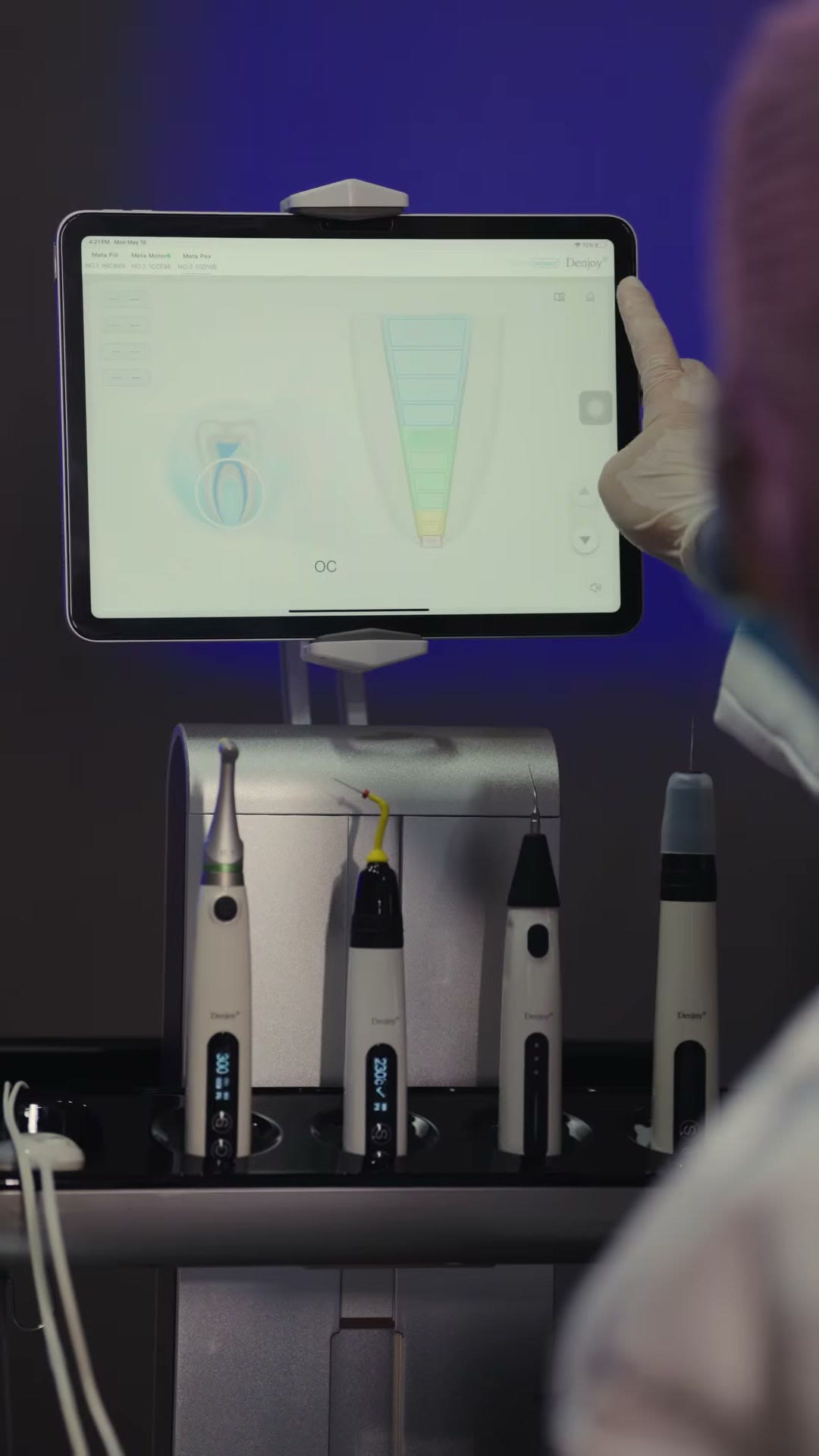 The Denjoy endodontic cart with the tablet showing the apex reading